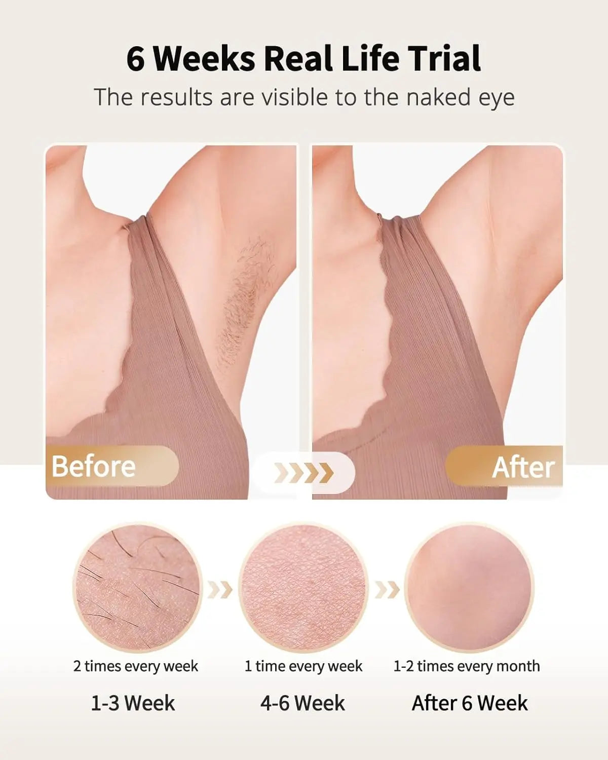 Beautae Forever Smooth IPL